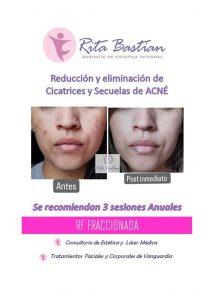 Rita Bastian – Estética Láser